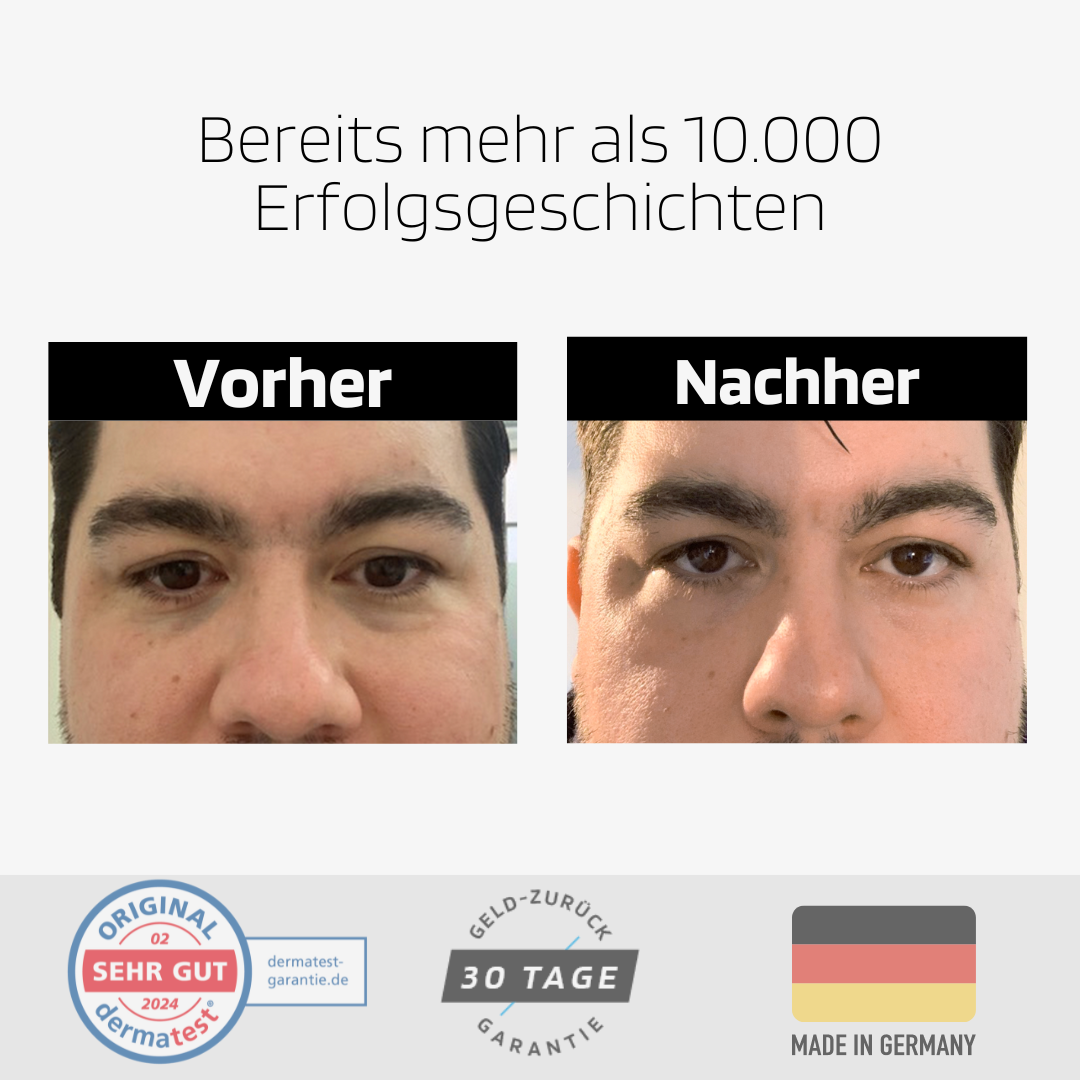 Anti Augenringe Routine