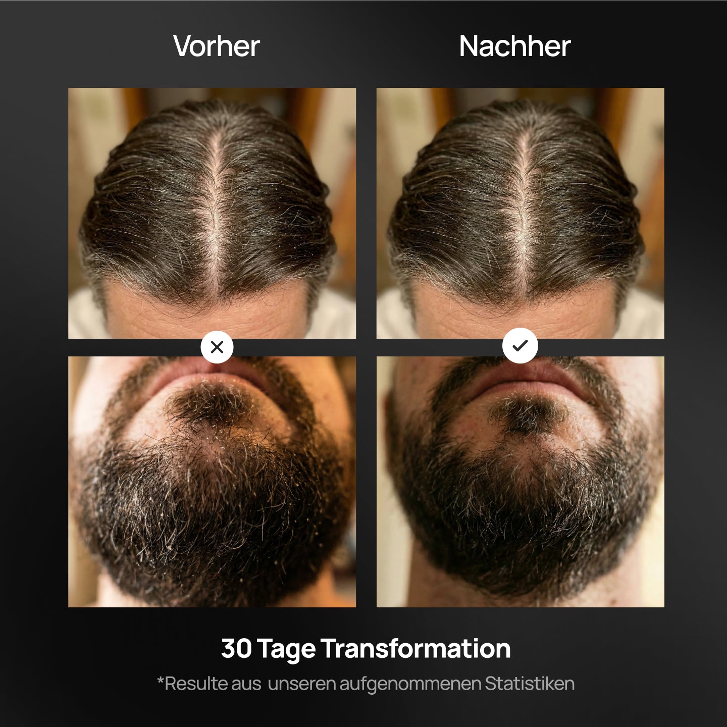 Anti Schuppen Shampoo - Starter Set - Für Haar & Bart